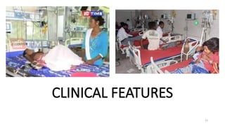 CLINICAL FEATURES
23
 