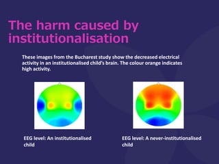 The harm caused by
institutionalisation
These images from the Bucharest study show the decreased electrical
activity in an...