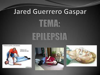 Jared Guerrero Gaspar TEMA: EPILEPSIA 