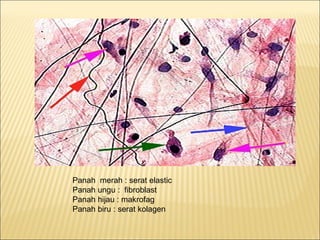 Panah merah : serat elastic
Panah ungu : fibroblast
Panah hijau : makrofag
Panah biru : serat kolagen
 