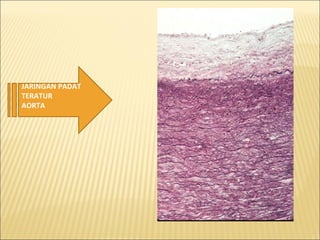 JARINGAN PADAT
TERATUR
AORTA
 