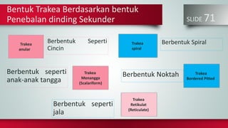SLIDE 71
Berbentuk seperti
anak-anak tangga
Berbentuk Seperti
Cincin
Berbentuk Noktah
Berbentuk SpiralTrakea
anular
Trakea
Menangga
(Scalariform)
Trakea
spiral
Trakea
Bordered Pitted
Bentuk Trakea Berdasarkan bentuk
Penebalan dinding Sekunder
Trakea
Retikulat
(Reticulate)
Berbentuk seperti
jala
 