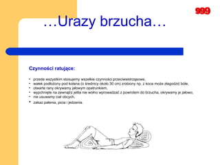 … Urazy brzucha…   Czynności ratujące: przede wszystkim stosujemy wszelkie czynności przeciwwstrząsowe, wałek podłożony pod kolana (o średnicy około 30 cm) zrobiony np. z koca może złagodzić bóle,  otwarte rany okrywamy jałowym opatrunkiem,  wypchnięte na zewnątrz jelita nie wolno wprowadzać z powrotem do brzucha, okrywamy je jałowo,   nie usuwamy ciał obcych,  zakaz palenia, picia i jedzenia.   
