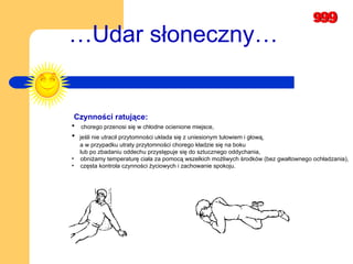 Czynności ratujące: chorego przenosi się w chłodne ocienione miejsce,   jeśli nie utracił przytomności układa się z uniesionym tułowiem i głową,  a w przypadku utraty przytomności chorego kładzie się na boku  lub po zbadaniu oddechu przystępuje się do sztucznego oddychania,   obniżamy temperaturę ciała za pomocą wszelkich możliwych środków (bez gwałtownego ochładzania),   częsta kontrola czynności życiowych i zachowanie spokoju.  … Udar słoneczny… 