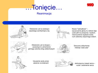 … Tonięcie… Otwieranie ust na siedząco  zapobiega zachłyśnięciu się.   Otwieranie ust na lezące –  -powoduje to udrożnienie  górnego odcinka dróg oddechowych  Usuwanie wody przez  uleżenie na kolanach   Nosze "wahadłowe" –  opuszczenie głowy ku dołowi daje  ucisk jelit na przeponę i wydech,  równocześnie wypływa woda;  ruch odwrotny wspomaga wdech .  Sztuczne oddychanie  metodą "usta-usta"   Jednoręczny masaż serca –  -ucisk i zwolnienie serca   Reanimacja: 