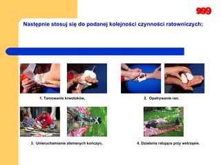 Następnie stosuj się do podanej kolejności czynności ratowniczych; 1. Tamowanie krwotoków, 2.  Opatrywanie ran, 3.  Unieruchamianie złamanych kończyn, 4. Działania ratujące przy wstrząsie. 