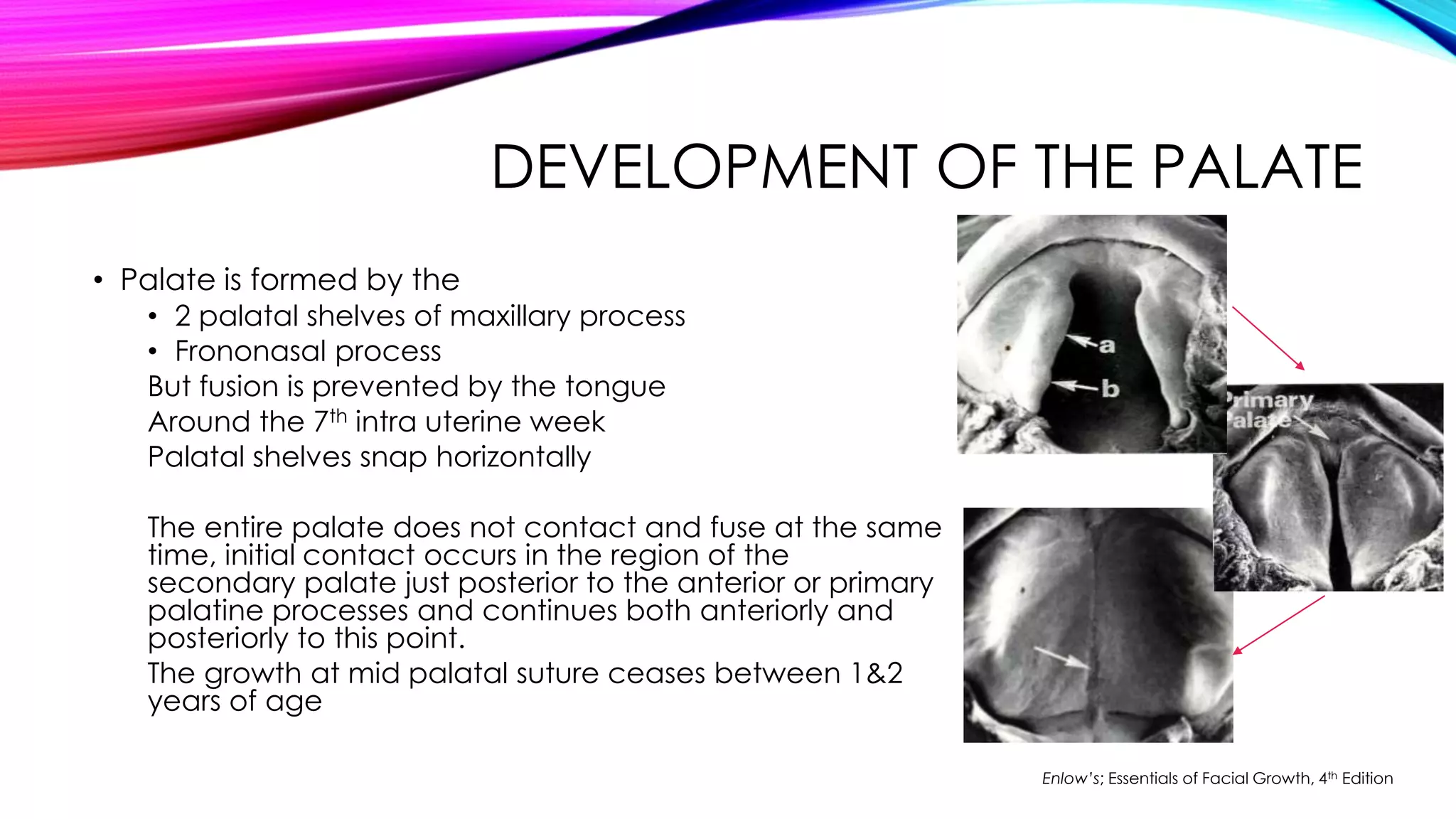 DEVELOPMENT OF THE PALATE 
• Palate is formed by the 
• 2 palatal shelves of maxillary process 
• Frononasal process 
But fusion is prevented by the tongue 
Around the 7th intra uterine week 
Palatal shelves snap horizontally 
The entire palate does not contact and fuse at the same 
time, initial contact occurs in the region of the 
secondary palate just posterior to the anterior or primary 
palatine processes and continues both anteriorly and 
posteriorly to this point. 
The growth at mid palatal suture ceases between 1&2 
years of age 
Enlow’s; Essentials of Facial Growth, 4th Edition 
 