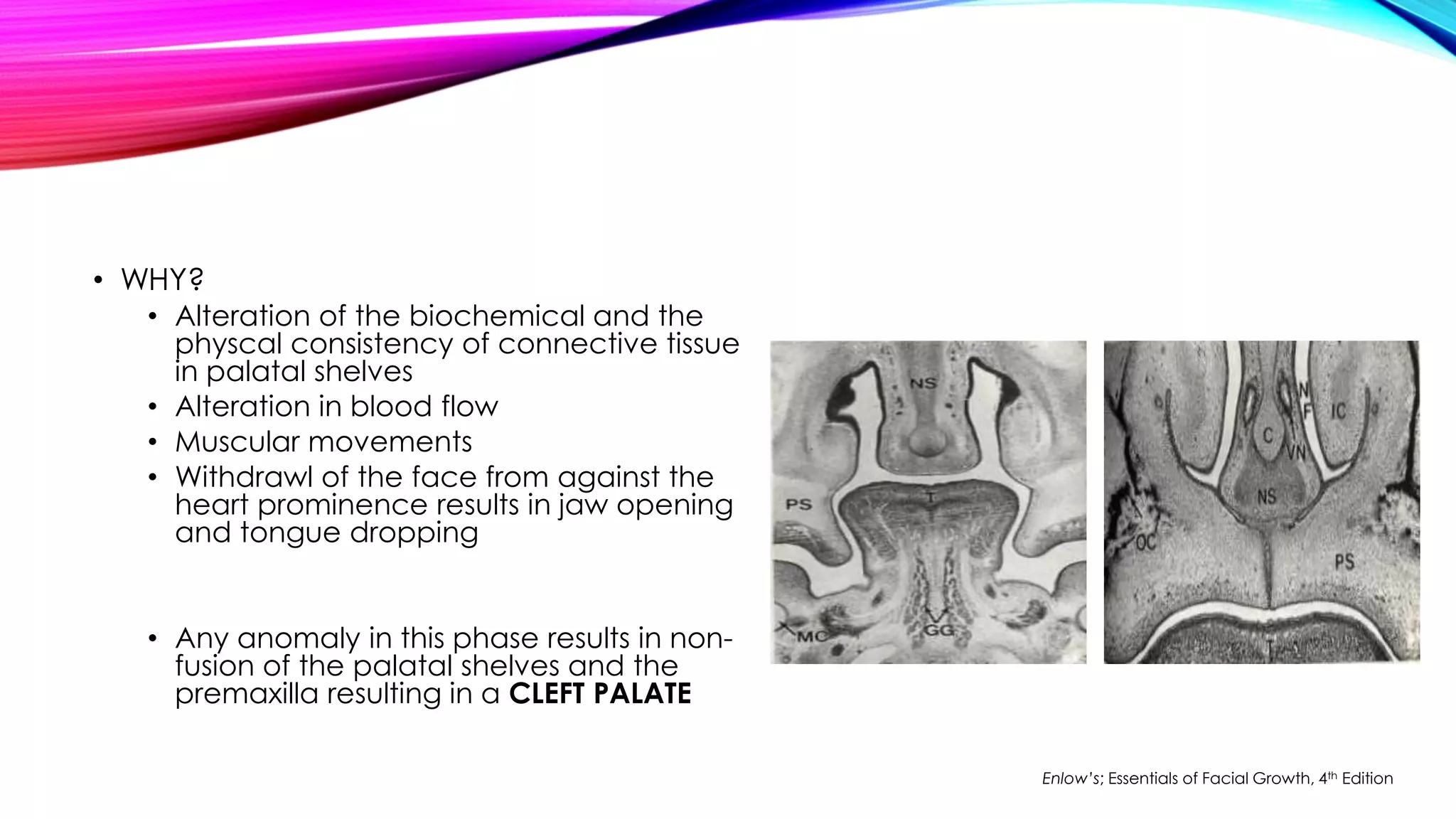 • WHY? 
• Alteration of the biochemical and the 
physcal consistency of connective tissue 
in palatal shelves 
• Alteration in blood flow 
• Muscular movements 
• Withdrawl of the face from against the 
heart prominence results in jaw opening 
and tongue dropping 
• Any anomaly in this phase results in non-fusion 
of the palatal shelves and the 
premaxilla resulting in a CLEFT PALATE 
Enlow’s; Essentials of Facial Growth, 4th Edition 
 