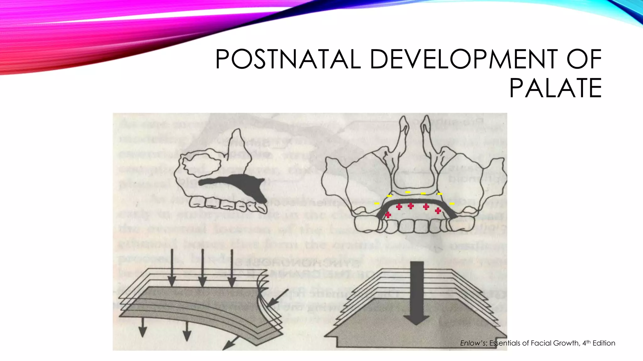 POSTNATAL DEVELOPMENT OF 
PALATE 
Enlow’s; Essentials of Facial Growth, 4th Edition 
 