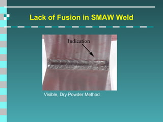 Lack of Fusion in SMAW Weld
Indication

Visible, Dry Powder Method

 