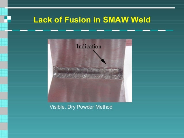 Lack Of Sidewall Fusion Lack Of Sidewall Fusion