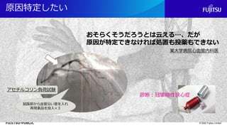 FUJITSU-PUBLIC
原因特定したい
© 2022 Fujitsu Limited
アセチルコリン負荷試験
鼠蹊部から血管沿い管を入れ
再現薬品を投入×３
鼠蹊部から血管沿い管を入れ
再現薬品を投入×３
おそらくそうだろうとは云える…、だが
原因が特定できなければ処置も投薬もできない
診断：冠攣縮性狭心症
某大学病院心血管内科医
 