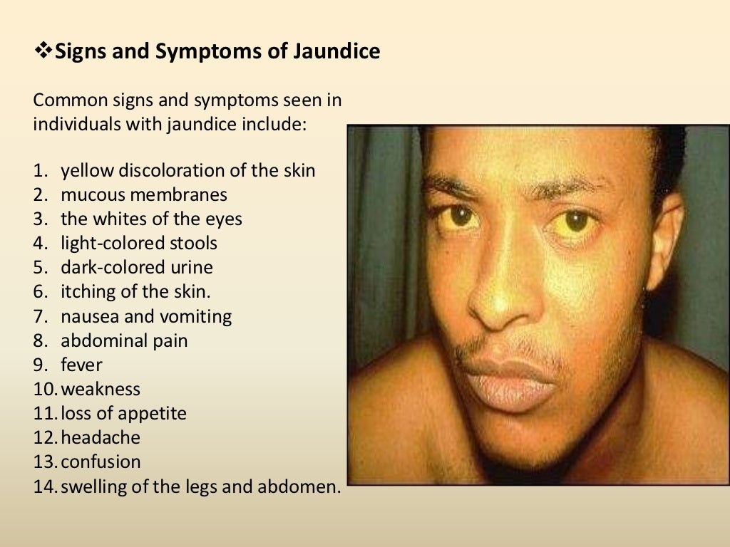 All about Jaundice
