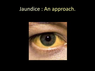 Jaundice : An approach.

 