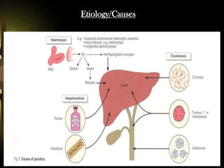 Etiology/Causes

 