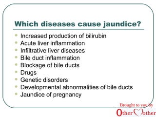 Which diseases cause jaundice? 
 Increased production of bilirubin 
 Acute liver inflammation 
 Infiltrative liver diseases 
 Bile duct inflammation 
 Blockage of bile ducts 
 Drugs 
 Genetic disorders 
 Developmental abnormalities of bile ducts 
 Jaundice of pregnancy 
Brought to you by 
 