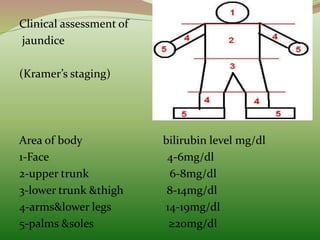 Clinical assessment of
jaundice
(Kramer’s staging)
Area of body bilirubin level mg/dl
1-Face 4-6mg/dl
2-upper trunk 6-8mg/dl
3-lower trunk &thigh 8-14mg/dl
4-arms&lower legs 14-19mg/dl
5-palms &soles ≥20mg/dl
 
