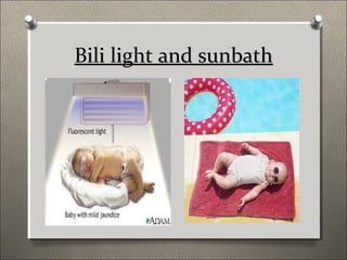 Jaundice | PPT