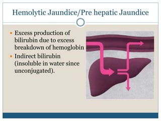 Hemolytic Jaundice/Pre hepatic Jaundice
 Excess production of
bilirubin due to excess
breakdown of hemoglobin
 Indirect bilirubin
(insoluble in water since
unconjugated).
 