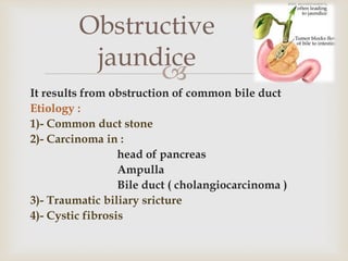 
It results from obstruction of common bile duct
Etiology :
1)- Common duct stone
2)- Carcinoma in :
head of pancreas
Ampulla
Bile duct ( cholangiocarcinoma )
3)- Traumatic biliary sricture
4)- Cystic fibrosis
Obstructive
jaundice
 