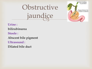 
Urine :
bilirubinurea
Stoole :
Abscent bile pigment
Ultrasound :
Dilated bile duct
Obstructive
jaundice
 