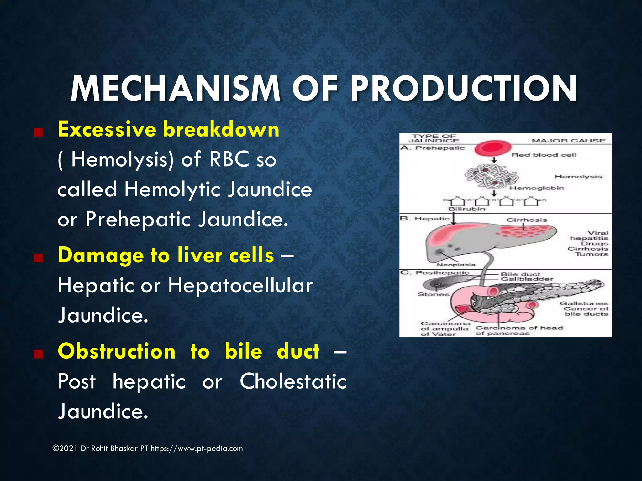 MECHANISM OF PRODUCTION
©2021 Dr Rohit Bhaskar PT https://www.pt-pedia.com
■ Excessive breakdown
( Hemolysis) of RBC so
called Hemolytic Jaundice
or Prehepatic Jaundice.
■ Damage to liver cells –
Hepatic or Hepatocellular
Jaundice.
■ Obstruction to bile duct –
Post hepatic or Cholestatic
Jaundice.
 