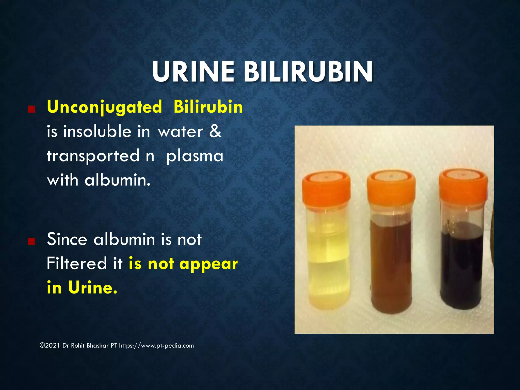 URINE BILIRUBIN
©2021 Dr Rohit Bhaskar PT https://www.pt-pedia.com
■ Unconjugated Bilirubin
is insoluble in water &
transported n plasma
with albumin.
■ Since albumin is not
Filtered it is not appear
in Urine.
 