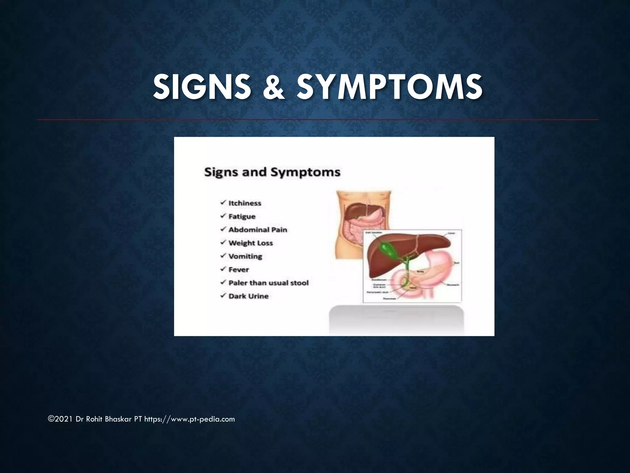 SIGNS & SYMPTOMS
©2021 Dr Rohit Bhaskar PT https://www.pt-pedia.com
 