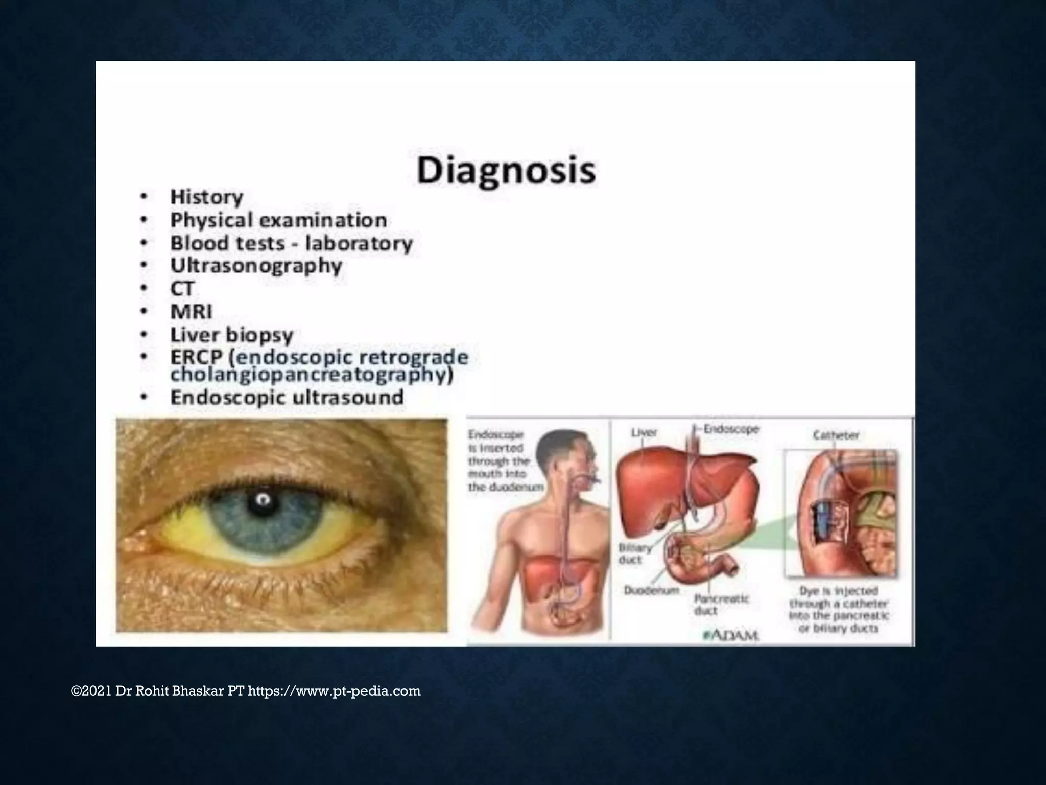 ©2021 Dr Rohit Bhaskar PT https://www.pt-pedia.com
 