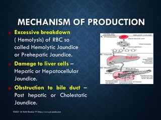 Excessive Rbc Breakdown Jaundice - Dr Rohit Bhaskar | PDF