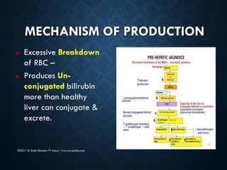 Excessive Rbc Breakdown Jaundice - Dr Rohit Bhaskar | PDF