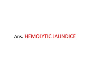 Ans. HEMOLYTIC JAUNDICE
 