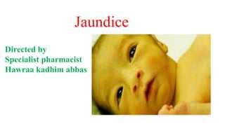 Jaundice
Directed by
Specialist pharmacist
Hawraa kadhim abbas
 