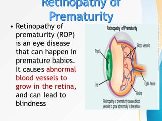 • Retinopathy of
prematurity (ROP)
is an eye disease
that can happen in
premature babies.
It causes abnormal
blood vessels to
grow in the retina,
and can lead to
blindness
 