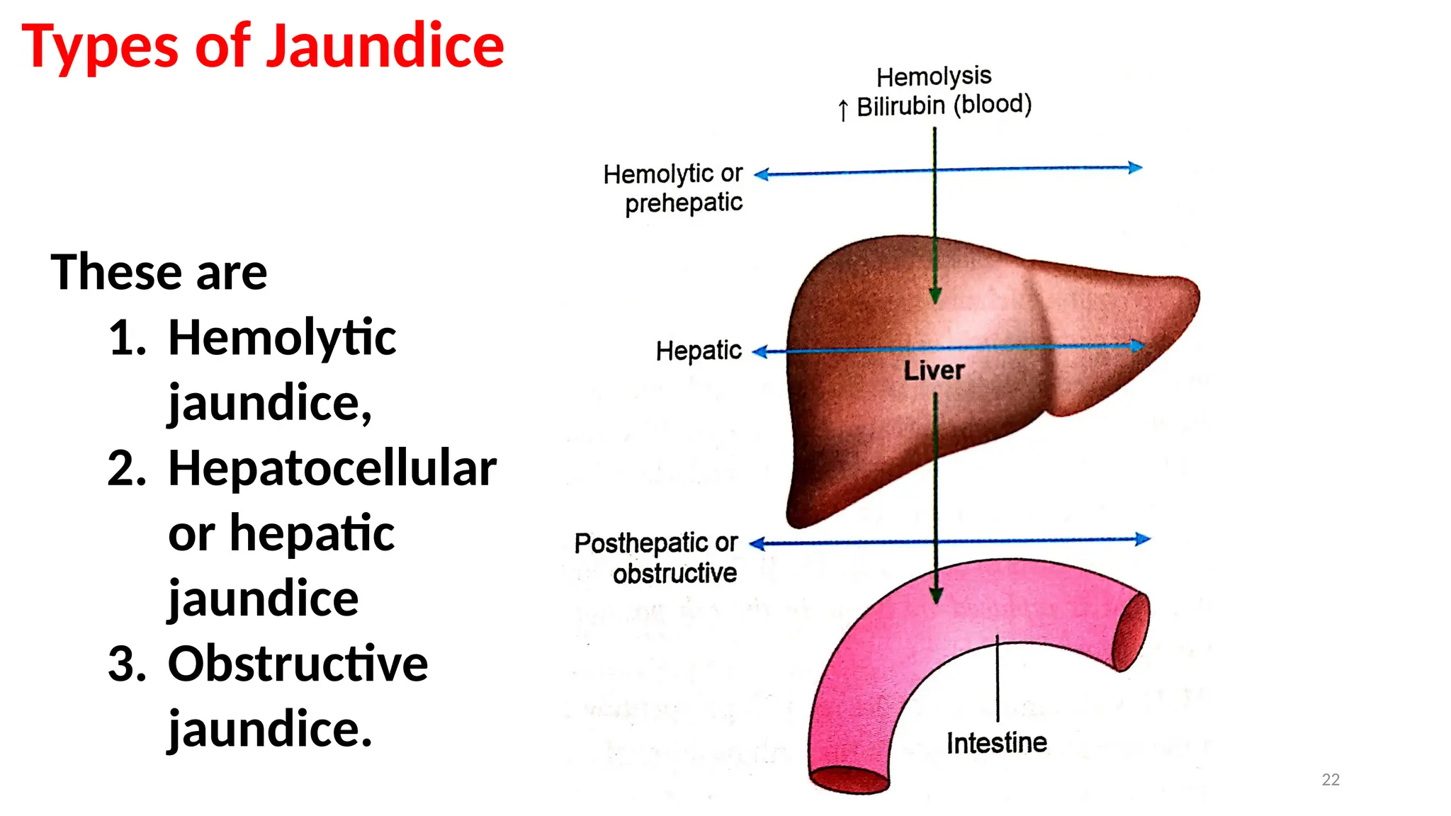 PATHOPHYSIOLOGY OF JAUNDICE AND ITS TYPES.pptx