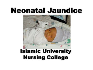 Neonatal Jaundice
Islamic University
Nursing College
 