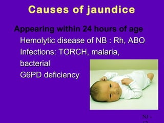 Causes of jaundice
Appearing within 24 hours of age
• Hemolytic disease of NB : Rh, ABO
• Infections: TORCH, malaria,
  bacterial
• G6PD deficiency




                                  NJ -
 