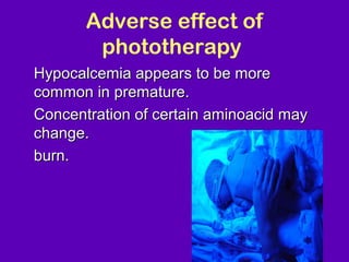 Adverse effect of
          phototherapy
• Hypocalcemia appears to be more
  common in premature.
• Concentration of certain aminoacid may
  change.
• burn.




                                       NJ -
 