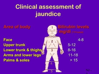 Clinical assessment of
             jaundice

Area of body           Bilirubin levels
                       mg/dl (*17=umol)
Face                             4-8
Upper trunk                 5-12
Lower trunk & thighs        8-16
Arms and lower legs         11-18
Palms & soles                > 15

                                       NJ -
 