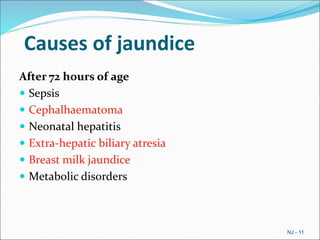 Causes of jaundice
After 72 hours of age
 Sepsis
 Cephalhaematoma
 Neonatal hepatitis
 Extra-hepatic biliary atresia
 Breast milk jaundice
 Metabolic disorders
NJ - 11
 