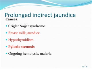 Prolonged indirect jaundice
Causes
 Crigler Najjar syndrome
 Breast milk jaundice
 Hypothyroidism
 Pyloric stenosis
 Ongoing hemolysis, malaria
NJ - 26
 