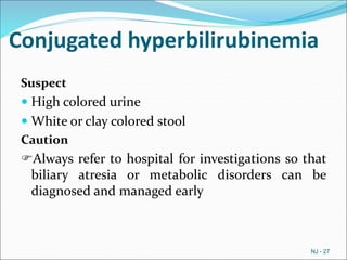 Conjugated hyperbilirubinemia
Suspect
 High colored urine
 White or clay colored stool
Caution
Always refer to hospital for investigations so that
biliary atresia or metabolic disorders can be
diagnosed and managed early
NJ - 27
 