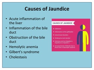Causes of Jaundice
• Acute inflammation of
the liver
• Inflammation of the bile
duct
• Obstruction of the bile
duct
• Hemolytic anemia
• Gilbert's syndrome
• Cholestasis
 