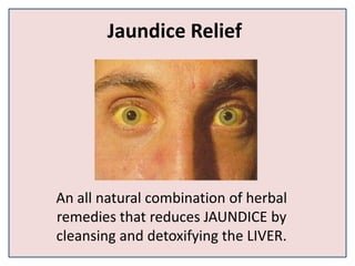 Jaundice Relief
An all natural combination of herbal
remedies that reduces JAUNDICE by
cleansing and detoxifying the LIVER.
 