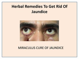 Herbal Remedies To Get Rid Of
Jaundice
MIRACULUS CURE OF JAUNDICE
 