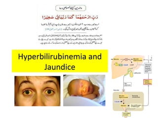 Hyperbilirubinemia and
Jaundice
 