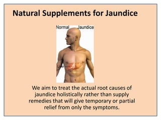 Natural Supplements for Jaundice
We aim to treat the actual root causes of
jaundice holistically rather than supply
remedies that will give temporary or partial
relief from only the symptoms.
 