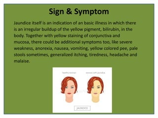 Sign & Symptom
Jaundice itself is an indication of an basic illness in which there
is an irregular buildup of the yellow pigment, bilirubin, in the
body. Together with yellow staining of conjunctiva and
mucosa, there could be additional symptoms too, like severe
weakness, anorexia, nausea, vomiting, yellow colored pee, pale
stools sometimes, generalized itching, tiredness, headache and
malaise.
 