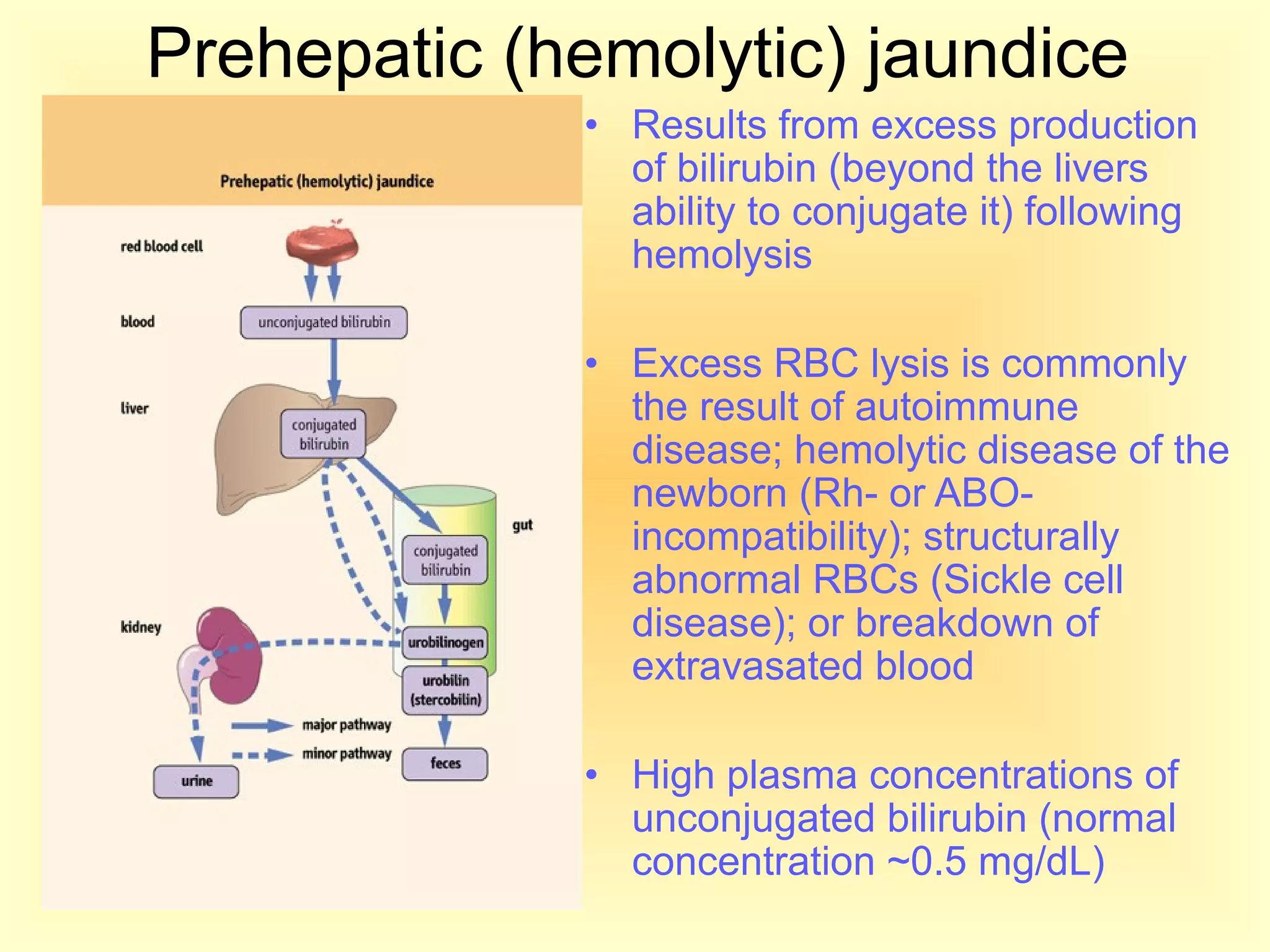 Prehepatic (hemolytic) jaundice
• Results from excess production
of bilirubin (beyond the livers
ability to conjugate it) following
hemolysis
• Excess RBC lysis is commonly
the result of autoimmune
disease; hemolytic disease of the
newborn (Rh- or ABO-
incompatibility); structurally
abnormal RBCs (Sickle cell
disease); or breakdown of
extravasated blood
• High plasma concentrations of
unconjugated bilirubin (normal
concentration ~0.5 mg/dL)
 