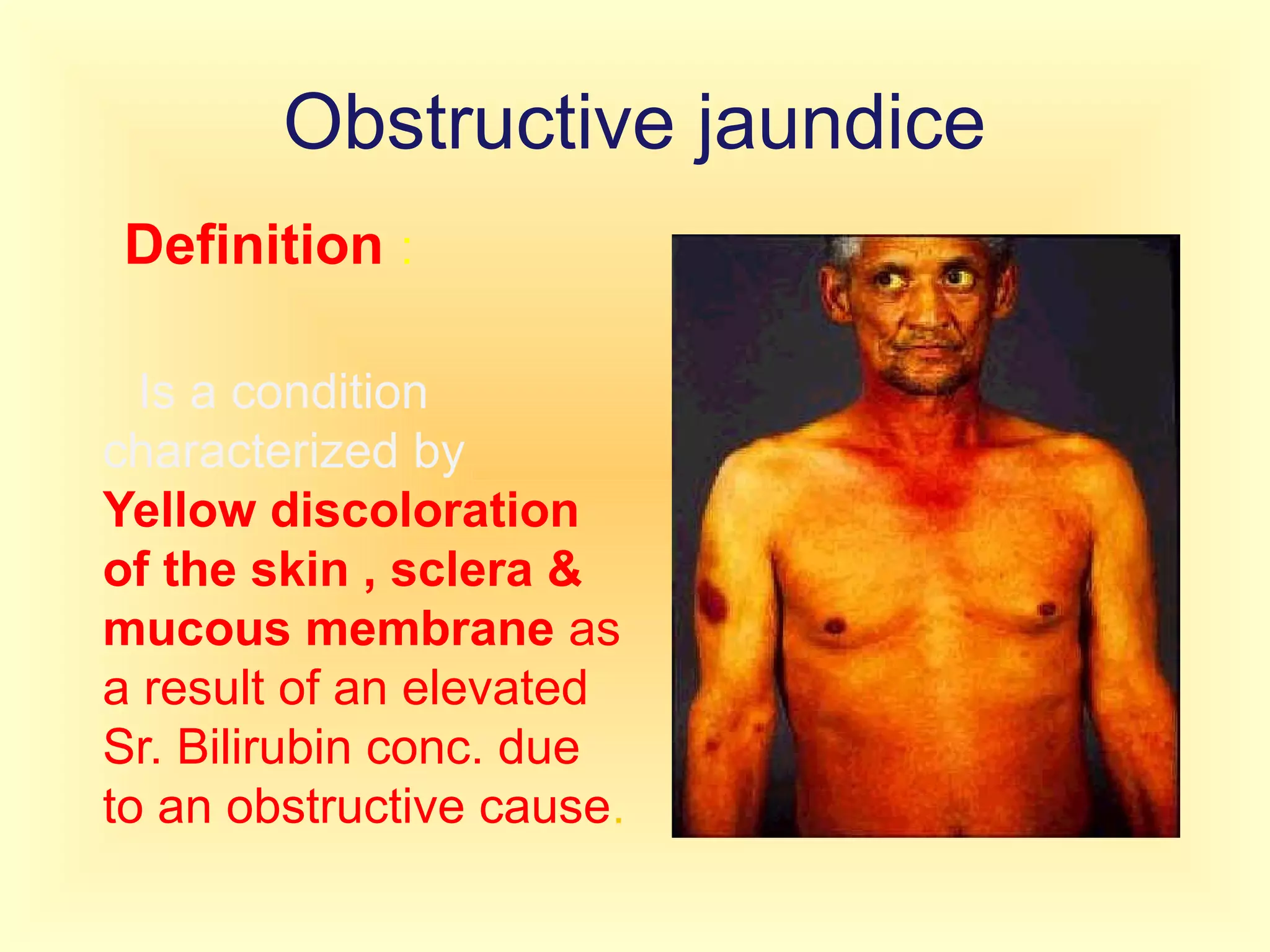 Obstructive jaundice
Definition :
Is a condition
characterized by
Yellow discoloration
of the skin , sclera &
mucous membrane as
a result of an elevated
Sr. Bilirubin conc. due
to an obstructive cause.
 